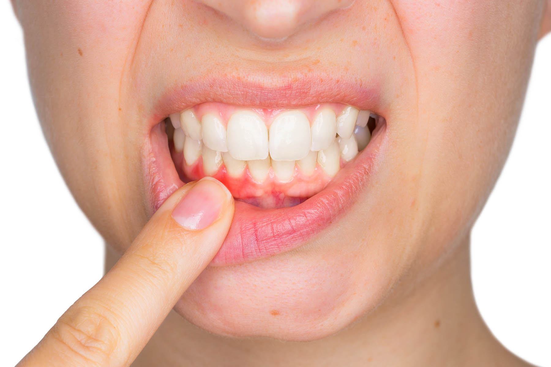 periodoncia Ayamonte