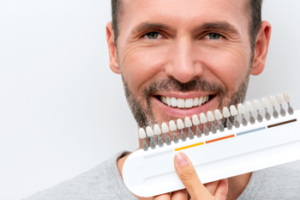 Carillas Dentales Ayamonte